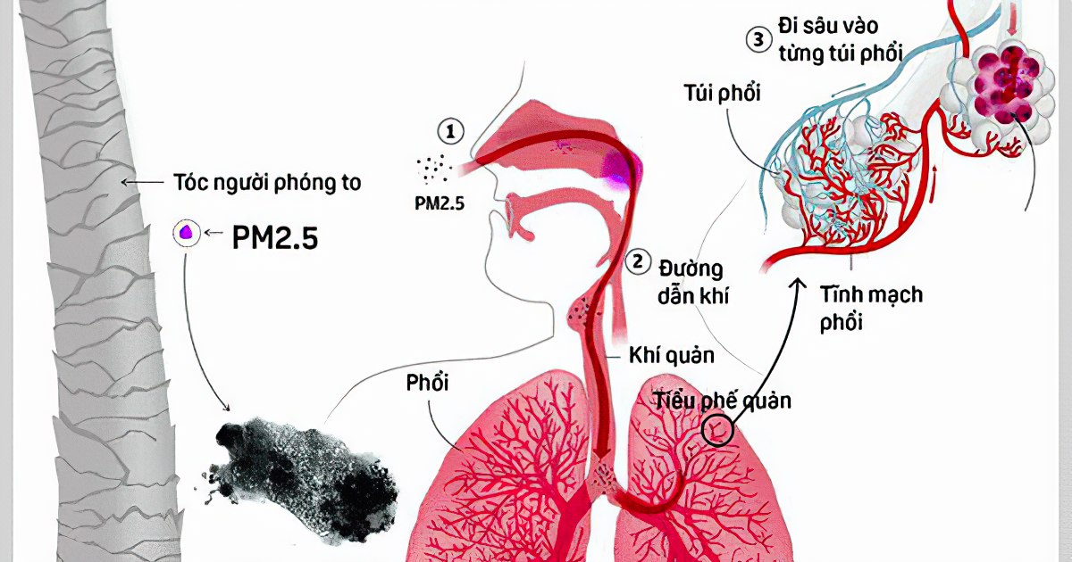 Bụi Pm 2.5 cực kỳ nguy hiểm đối với con người